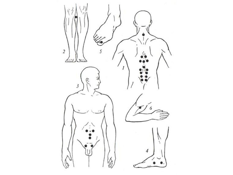 Massage de l'acupuncture
